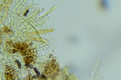 Trichopeziza