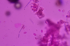 Radulomyces confluens