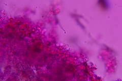 Radulomyces confluens