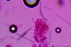 Radulomyces confluens