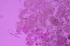 Radulomyces confluens