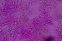 Radulomyces confluens