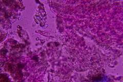 Radulomyces confluens