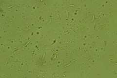 Discosia fraxinea