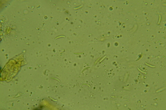 Discosia fraxinea