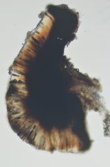 Tetramelas triphragmioides