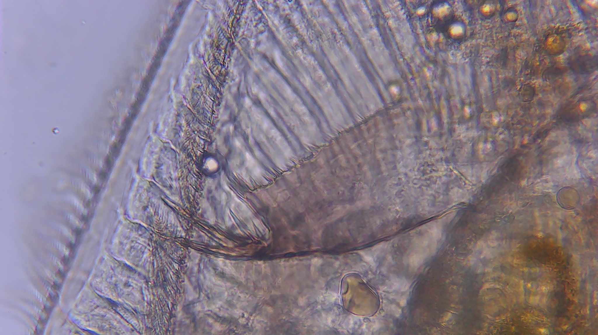 Picripleuroxus denticulatus (Birge, 1879)