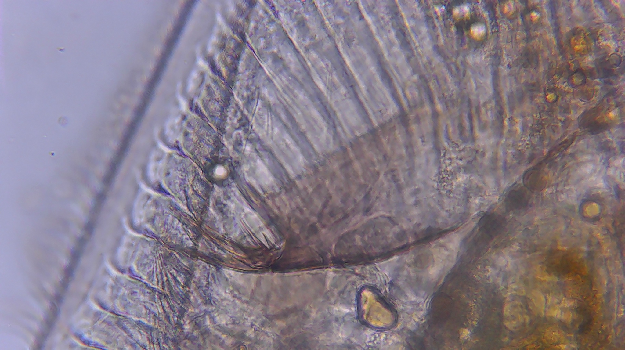 Picripleuroxus denticulatus (Birge, 1879)