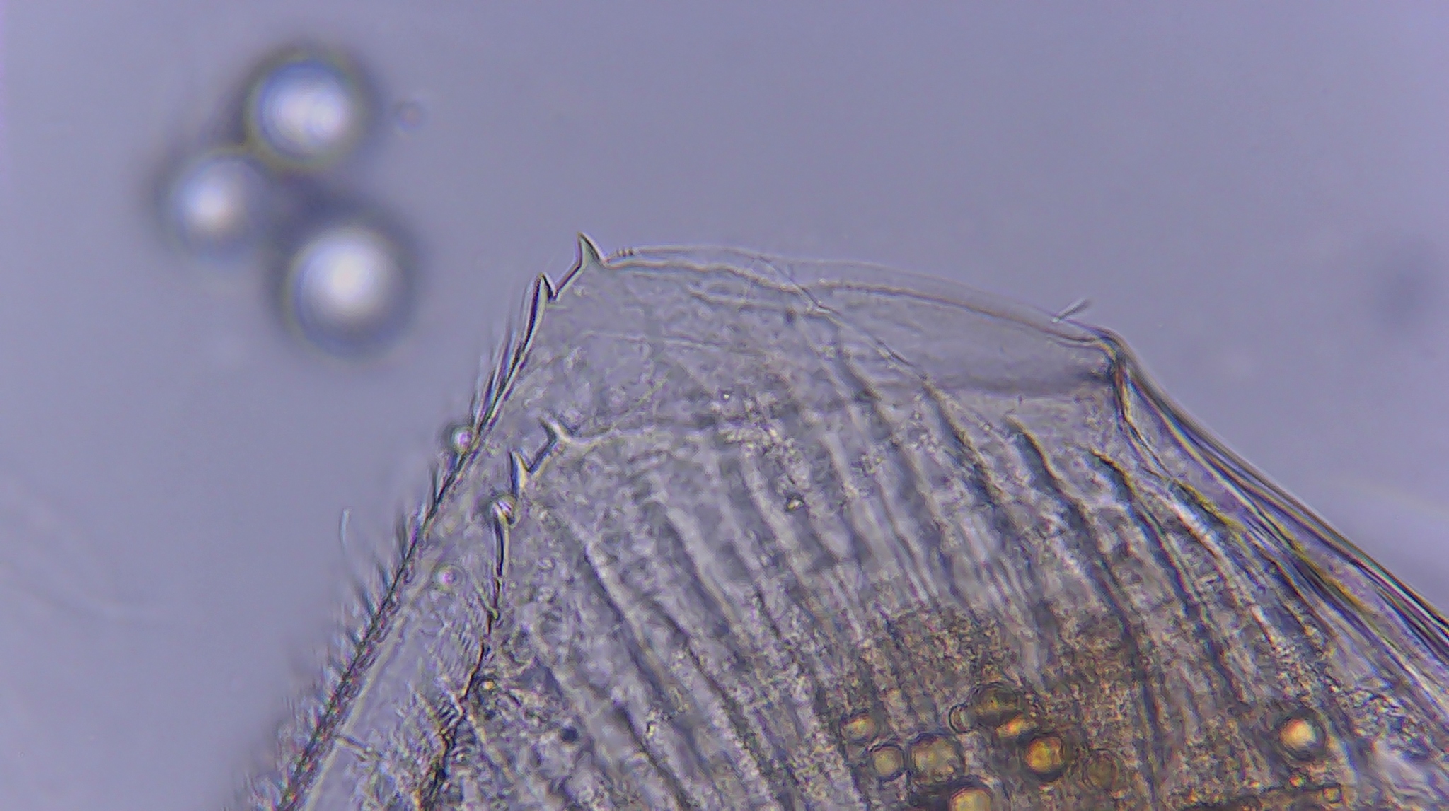 Picripleuroxus denticulatus (Birge, 1879)