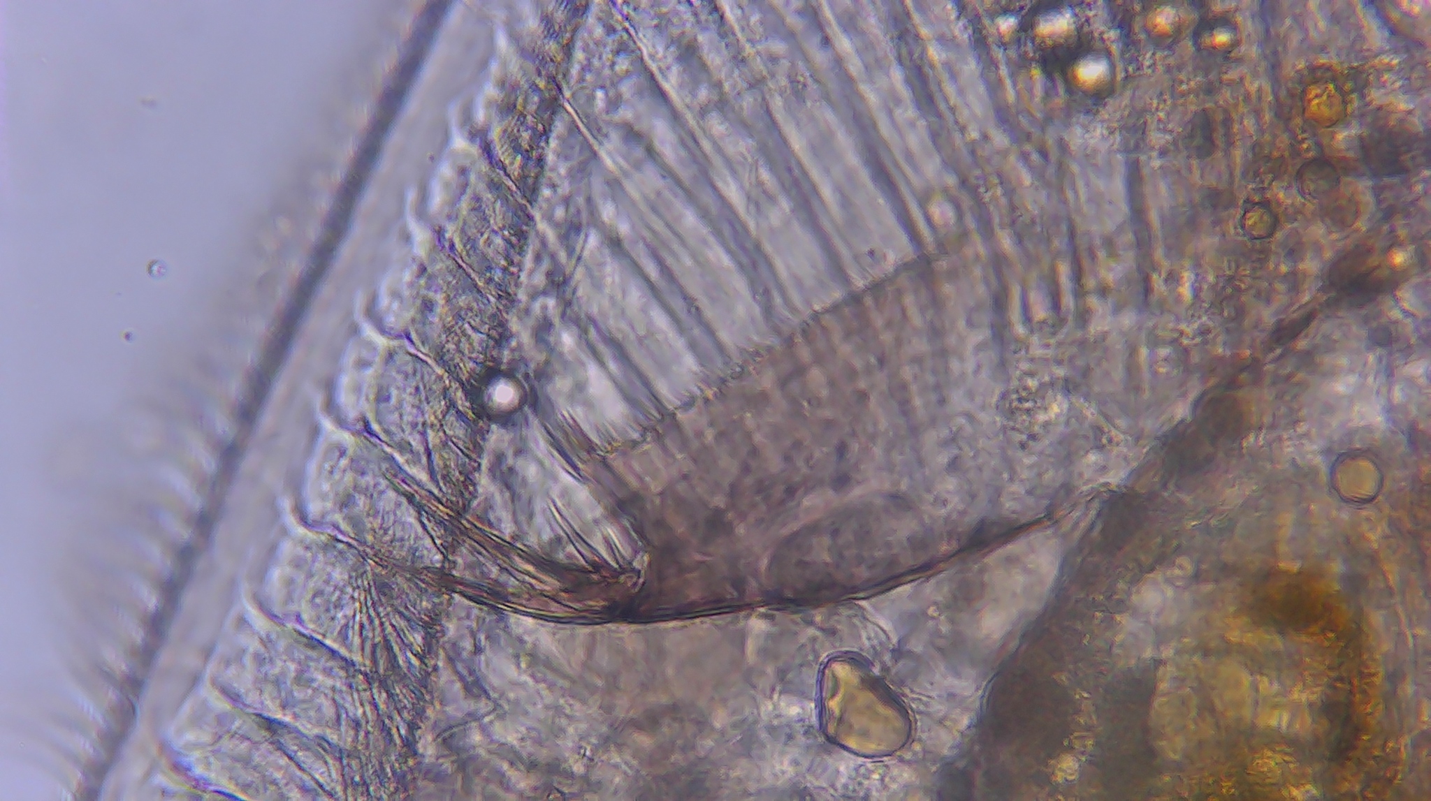 Picripleuroxus denticulatus (Birge, 1879)