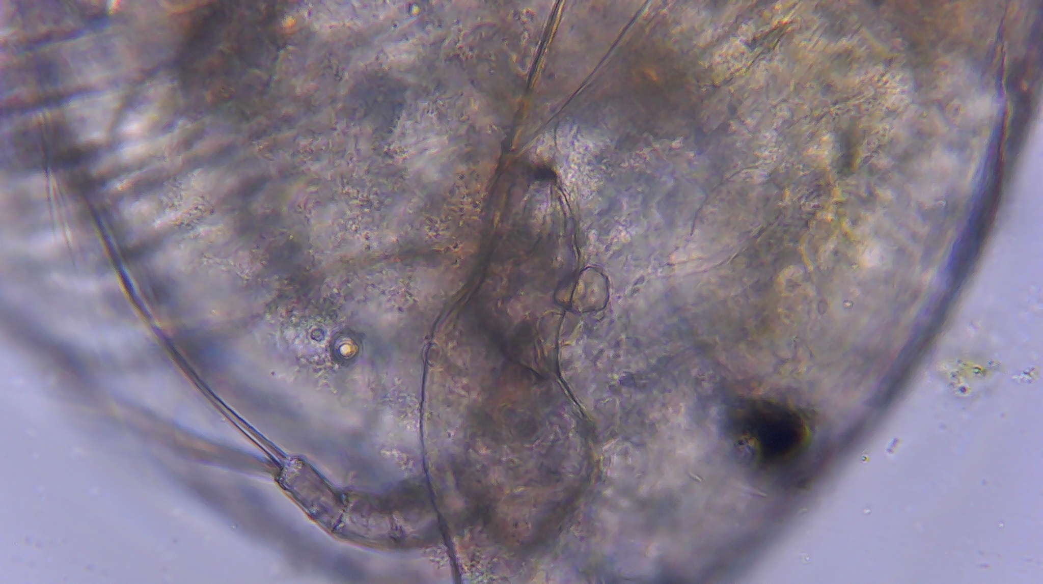 Picripleuroxus denticulatus (Birge, 1879)