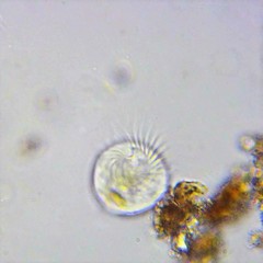 Strobilidium caudatum