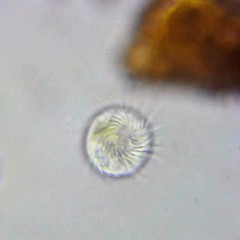 Strobilidium caudatum