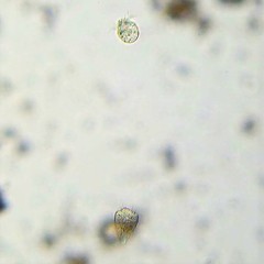 Strobilidium caudatum