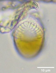 Surirella