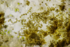 Xanthoriicola physciae