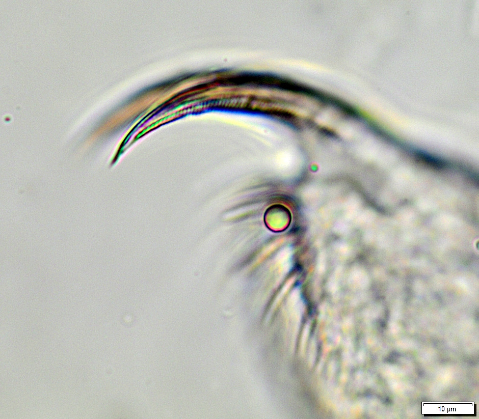 Daphnia galeata Sars, 1864