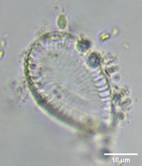 Surirella
