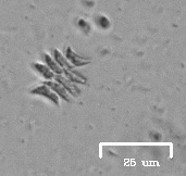 Scenedesmus