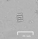 Scenedesmus