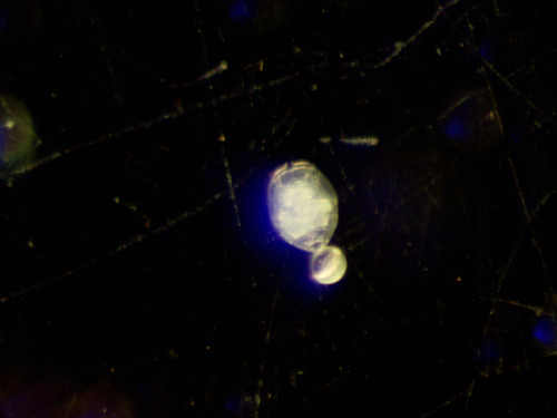 Brachionus angularis