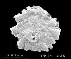 Planogypsina squamiformis
