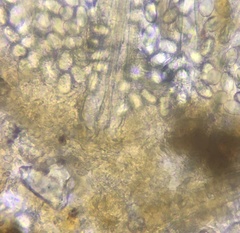 Lasiobolus intermedius