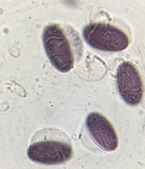 Ascobolus michaudii