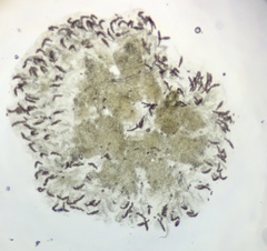 Ascobolus furfuraceus