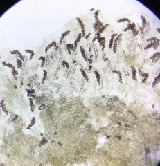 Ascobolus furfuraceus