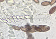 Ascobolus furfuraceus
