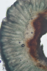 Mycoblastus sanguinarius