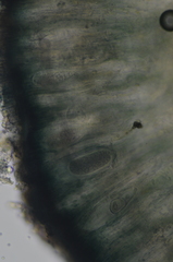 Mycoblastus sanguinarius