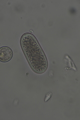 Mycoblastus sanguinarius