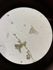 Vorticella campanula