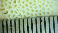 Elmerina cladophora