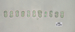 Umbilicaria nodulospora