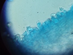 Chlorophyllum molybdites