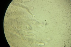 Amniculicolaceae