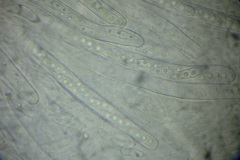 Amniculicolaceae