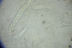 Amniculicolaceae