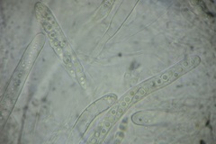 Amniculicolaceae