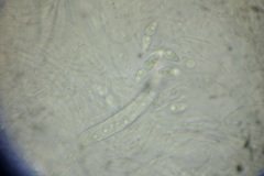 Amniculicolaceae