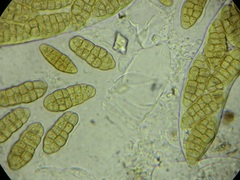 Stemphylium vesicarium