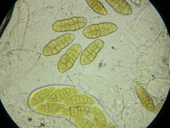 Stemphylium vesicarium