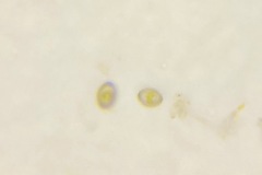 Cocconeis