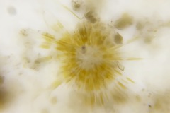 Heliozoa