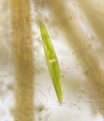 Closterium acerosum lanceolatum