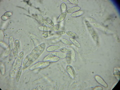 Fusarium sambucinum