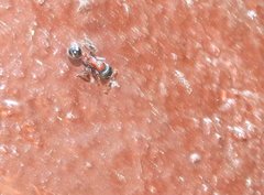 Dilobocondyla fouqueti